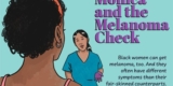 Monica and the Melanoma Check